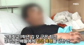 고등학교 선배들이 폭행하고 담뱃불로 지진 이유